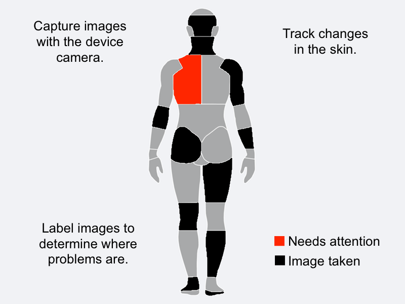 Pinpointing a mole on the body map